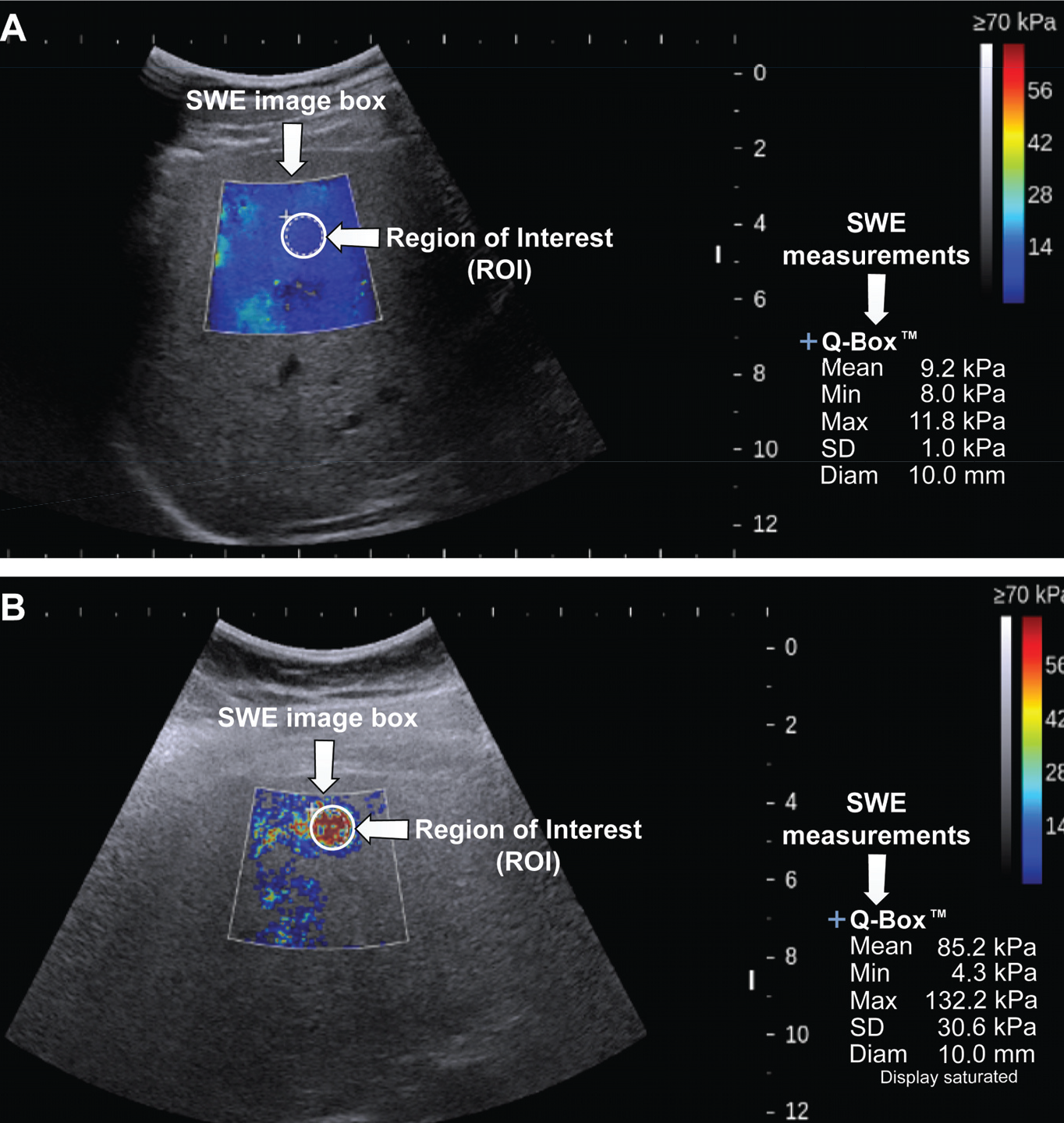 Top image is a high-quality SWE image enabled by our technology; bottom is more typical low-quality image.