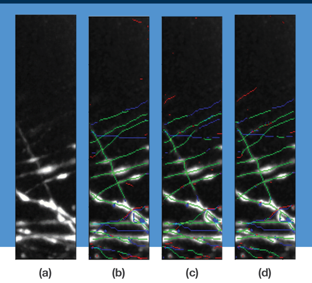 Four images show the results from experiments predicting centerline detections. in microscopy images of mouse brain.