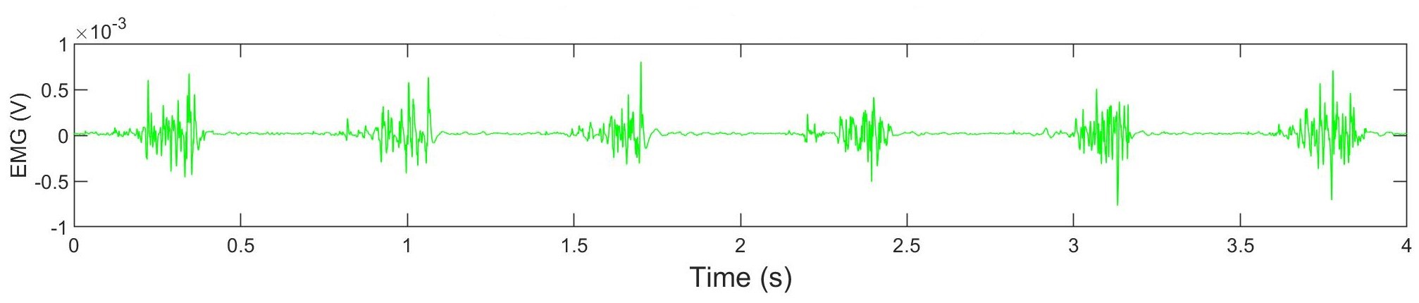 Delsys Trigno Research+ sensors combine EMG and IMU measurements. EMG signals provide information on muscle activity.